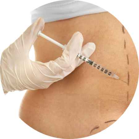 Dra. Mayte Peres - Biomedicina Estética: Hidrolipocarbox